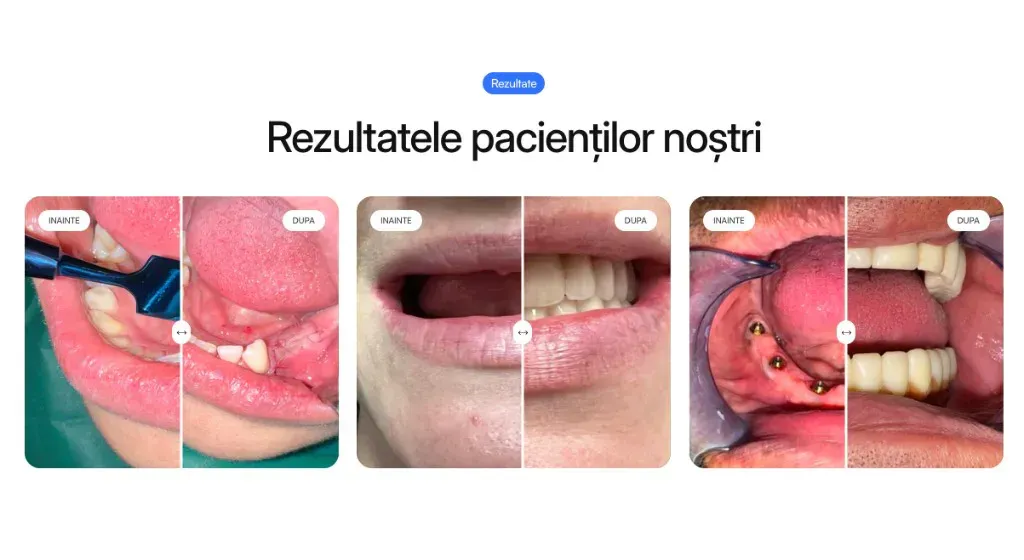 Galerie Rezultatele pacienților noștri, comparații înainte și după tratamente